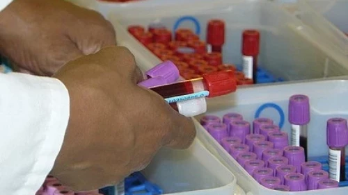 1ère Journée Scientifique Nationale de Transfusion Sanguine – 8 mars 2014 – Tébessa – Algérie
