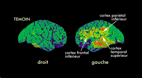 La Société Marocaine de Neuropsychologie : un Séminaire sur la dyslexie